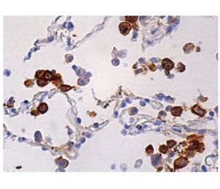 なあこん Alexa Fluor 594 anti-mouse CD206 MMR Antibody anti-CD206