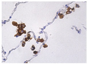 CD206/Mannose Receptor/MMR Antibody (D-1) | SCBT - Santa Cruz