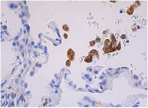 CD206/Mannose Receptor/MMR Antibody (D-1) | SCBT - Santa