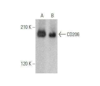 CD206/Mannose Receptor/MMR Antibody (D-1): m-IgGκ BP-HRP Bundle