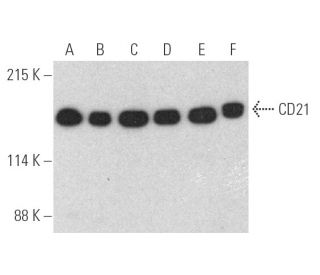 CD21 Antibody (A-3) - Western Blotting - Image 390979 