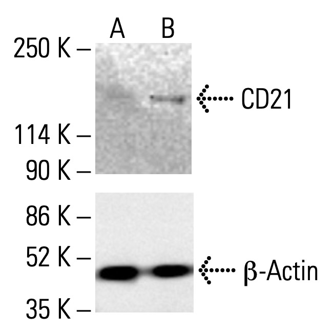 cd21-antibody-a-3-western-
