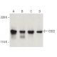 This polyclonal antibody has been discontinued. See our recommended <a href="cd22-antibody-d-5">CD22 (D-5)</a> monoclonal antibody (sample data shown). western blotting image from recommended CD22 (D-5) monoclonal antibody replacement. Image 399478