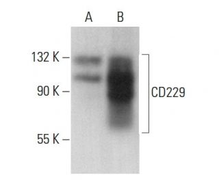 CD229 Antibody (3H1998) - Western Blotting - Image 376911 