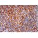 CD23 Antibody (BU38) - Immunohistochemistry - Image 293993
