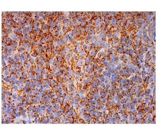 immunohistochemistry image from recommended CD23 (BU38) monoclonal antibody replacement. Image 293993
