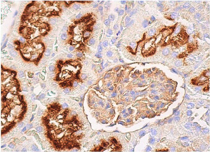 CD26 Antibody (5E8) | SCBT - Santa Cruz Biotechnology