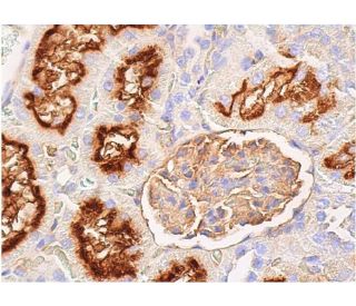 immunohistochemistry image from recommended CD26 (5E8) monoclonal antibody replacement. Image 367918