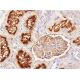 immunohistochemistry image from recommended CD26 (5E8) monoclonal antibody replacement. Image 367918