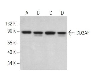 western blotting image from recommended CD2AP (B-4) monoclonal antibody replacement. Image 372361