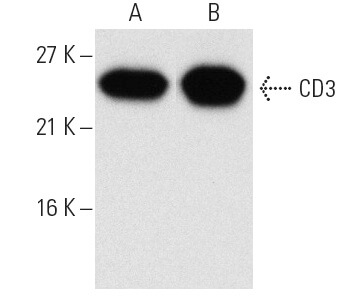 CD3 Antibody (PC3/188A) | SCBT - Santa Cruz Biotechnology