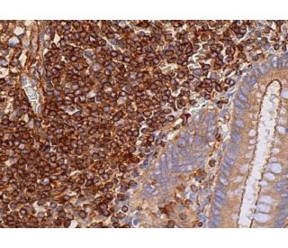 CD3-ζ Antibody (6B10.2) | SCBT - Santa Cruz Biotechnology CD3-ζ Antibody (6B10.2) | SCBT - Santa Cruz Biotechnology