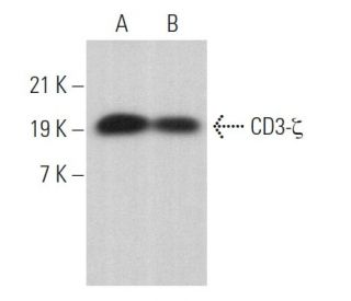 デタミネーションズ　DETERMINATIONS　CD3枚セット CD3-ζ Antibody (E-3) | SCBT - Santa Cruz Biotechnology