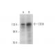CD30 Antibody (B-10) - Western Blotting - Image 318043 