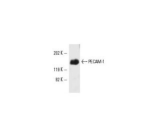 CD31/PECAM-1 Antibody (P2B1) - Western Blotting - Image 5080 