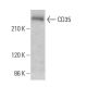 CD35 Antibody (Ber-MAC-DRC) - Western Blotting - Image 379197