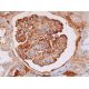 This polyclonal antibody has been discontinued. See our recommended <a href="cd35-antibody-e-11">CD35 (E-11)</a> monoclonal antibody (sample data shown). immunohistochemistry image from recommended CD35 (E-11) monoclonal antibody replacement. Image 289160