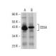This polyclonal antibody has been discontinued. See our recommended <a href="cd38-antibody-h-11">CD38 (H-11)</a> monoclonal antibody (sample data shown). western blotting image from recommended CD38 (H-11) monoclonal antibody replacement. Image 154717