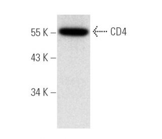 western blotting image from recommended CD4 (MT310) monoclonal antibody replacement. Image 4703
