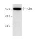 This polyclonal antibody has been discontinued. See our recommended <a href="cd4-antibody-mt310">CD4 (MT310)</a> monoclonal antibody (sample data shown). western blotting image from recommended CD4 (MT310) monoclonal antibody replacement. Image 4703