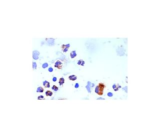 CD4 Antibody (MT310) | SCBT - Santa Cruz Biotechnology