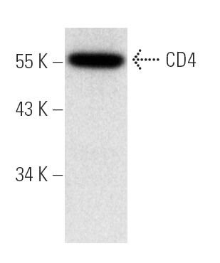 CD4 Antibody (MT310) | SCBT - Santa Cruz Biotechnology