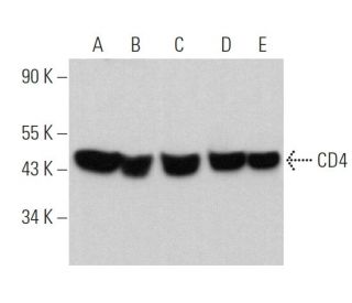 CD4 Antibody (5B4) - Western Blotting - Image 360425