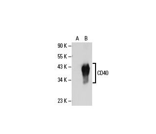 CD40 Antibody (H-10) | SCBT - Santa Cruz Biotechnology CD40 Antibody (H-10) | SCBT - Santa Cruz Biotechnology