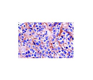 CD40 Antibody (LOB-11) | SCBT - Santa Cruz Biotechnology