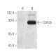 CD42b Antibody (E-8) - Western Blotting - Image 396364