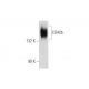 Dieser polyklonale Antikörper wird nicht mehr hergestellt. Wir empfehlen Ihnen unseren <a href="cd42b-antibody-e-8">CD42b (E-8)</a> monoklonalen Antikörper (Beispielsdaten werden angezeigt). western blotting image from recommended CD42b (E-8) monoclonal antibody replacement. Image 129772