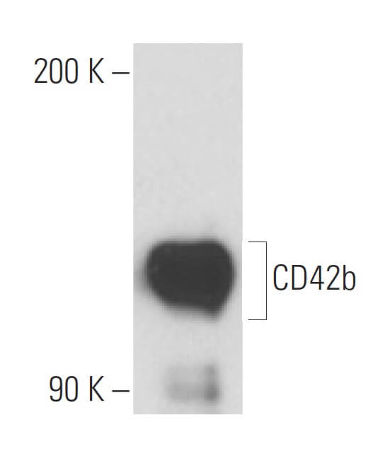 CD42b Antibody (SZ2) | SCBT - Santa Cruz Biotechnology CD42b Antibody (SZ2) | SCBT - Santa Cruz Biotechnology