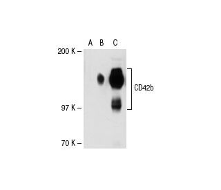 CD42b Antibody (PM6/40) - Western Blotting - Image 31138The Double Nickase Plasmid features a U6 promoter for sgRNA expression, a 20 nt targeting sequence, and a gRNA scaffold to guide Cas9n. It includes a CBh promoter for Cas9n (D10A) and puromycin resistance, GFP for transfection verification, and nuclear localization signals (NLS). The 2A peptide allows co-expression of Cas9n and Puro from a single promoter, enabling precise genome editing with reduced off-target effects.