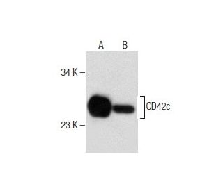 CD42c Antibody (F-11) - Western Blotting - Image 281801The Double Nickase Plasmid features a U6 promoter for sgRNA expression, a 20 nt targeting sequence, and a gRNA scaffold to guide Cas9n. It includes a CBh promoter for Cas9n (D10A) and puromycin resistance, GFP for transfection verification, and nuclear localization signals (NLS). The 2A peptide allows co-expression of Cas9n and Puro from a single promoter, enabling precise genome editing with reduced off-target effects. 