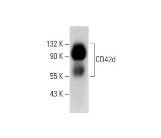 CD42d Antibody (G-11) | SCBT - Santa Cruz Biotechnology