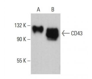 CD43 Antibody (0.N.117) - Western Blotting - Image 378208 