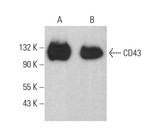 CD43 Antibody (84-3C1) - Western Blotting - Image 383754 