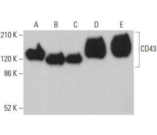 CD43 Antibody (DF-T1) - Western Blotting - Image 360283 