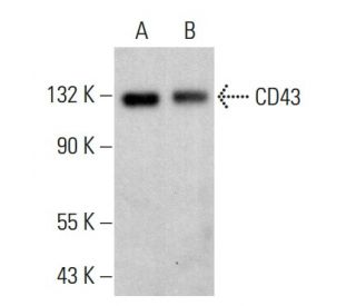 CD43 Antibody (0.N.117) - Western Blotting - Image 382258 