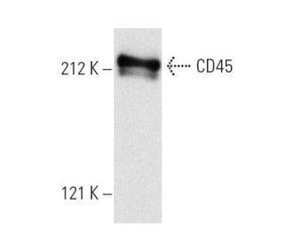 CD45 Antibody (MB4B4) - Western Blotting - Image 4849Each CRISPR/Cas9 Knockout (KO) Plasmid product consists of a pool of 3 plasmids designed to ensure identification and cleavage of a specific gene for maximum knockout efficiency. Each plasmid encodes a unique 20 nt sequence derived from the GeCKO (v2) library.