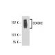 CD45RC Antibody (6A295) - Western Blotting - Image 17823 