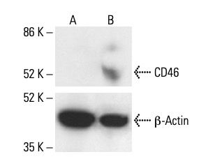 CD46 Antibody (M177) | SCBT - Santa Cruz Biotechnology
