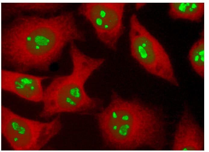 CD47 Antibody (B6H12) | SCBT - Santa Cruz Biotechnology