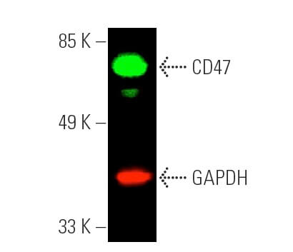 「高評価！」注目のレビュ cd47-antibody-b6h12-western- その他