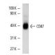 このポリクローナル抗体は販売終了となりました。弊社推奨の<a href="cd47-antibody-b6h12">CD47 (B6H12)</a>モノクローナル抗体をご覧ください(サンプルデータを表示)。 western blotting image from recommended CD47 (B6H12) monoclonal antibody replacement. Image 4882