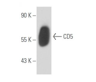 CD5 Antibody (CC17) - Western Blotting - Image 15582