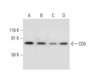 CD5 Antibody (D-9) - Western Blotting - Image 291968