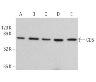 CD5 Antibody (UCH-T2) - Western Blotting - Image 360289 