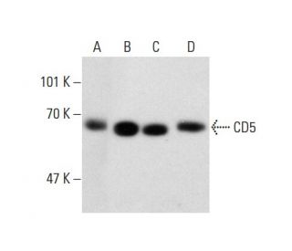 CD5 Antibody (CD5/54/F6) - Western Blotting - Image 137855
