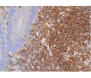 CD53 Antibody (B-12) - Immunohistochemistry - Image 387124 